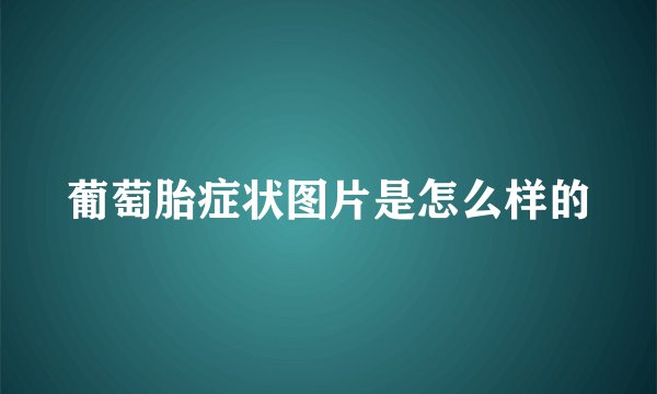 葡萄胎症状图片是怎么样的