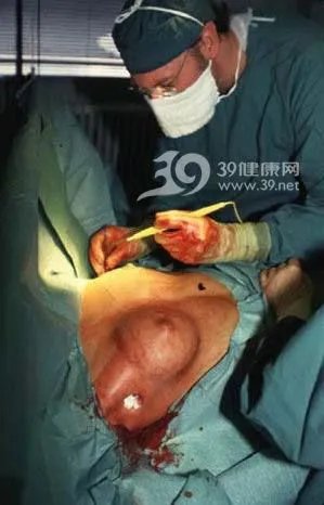 美女“隆胸手术”全程实录(组图)