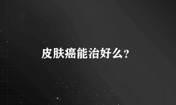 皮肤癌能治好么？