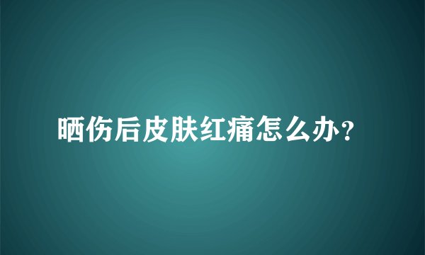 晒伤后皮肤红痛怎么办？