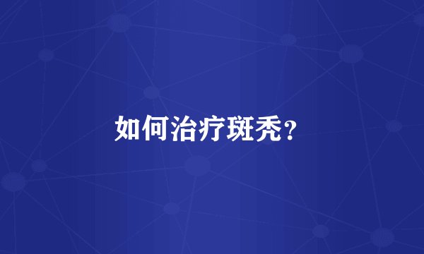 如何治疗斑秃?