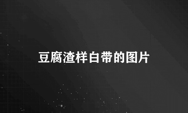 豆腐渣样白带的图片