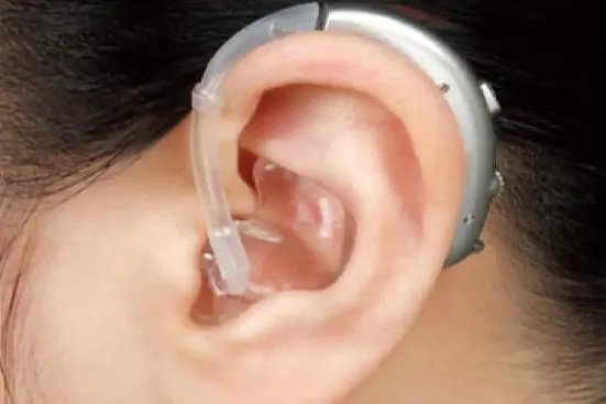 人工耳蜗真实图片