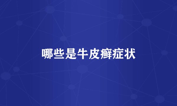 哪些是牛皮癣症状