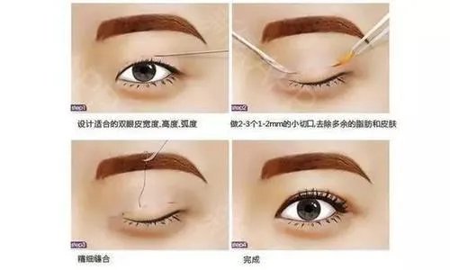韩式三点是什么意思?