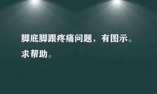 脚底脚跟疼痛问题，有图示。求帮助。
