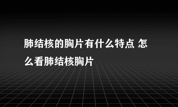 肺结核的胸片有什么特点 怎么看肺结核胸片