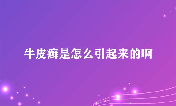牛皮癣是怎么引起来的啊