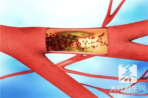 毛细血管破裂是怎么回事