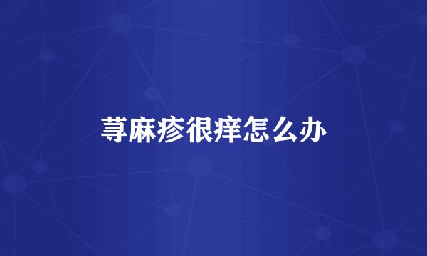 荨麻疹很痒怎么办