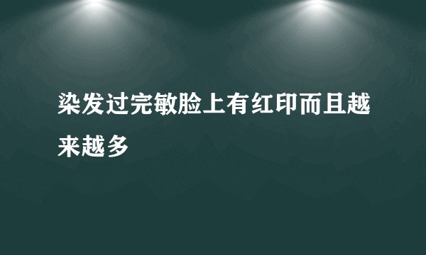 染发过完敏脸上有红印而且越来越多