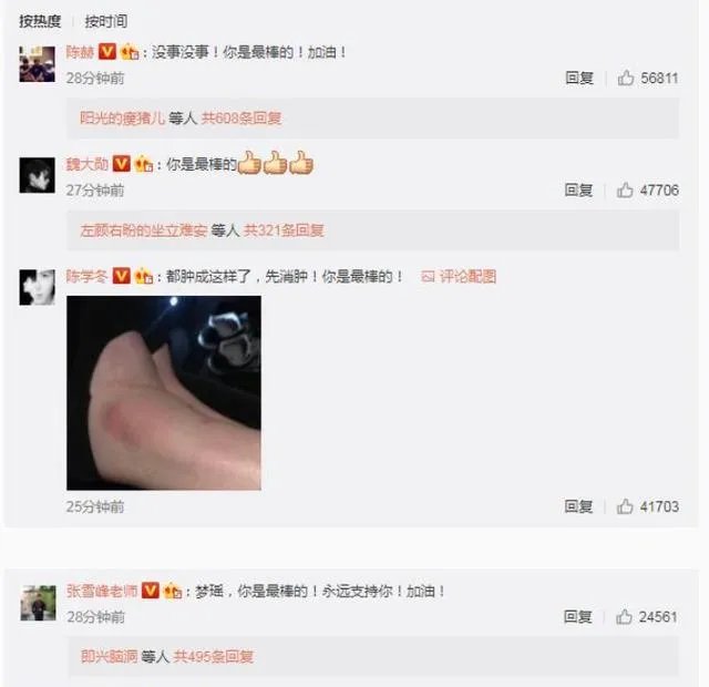 2017维秘秀奚梦瑶摔倒,你怎么看?