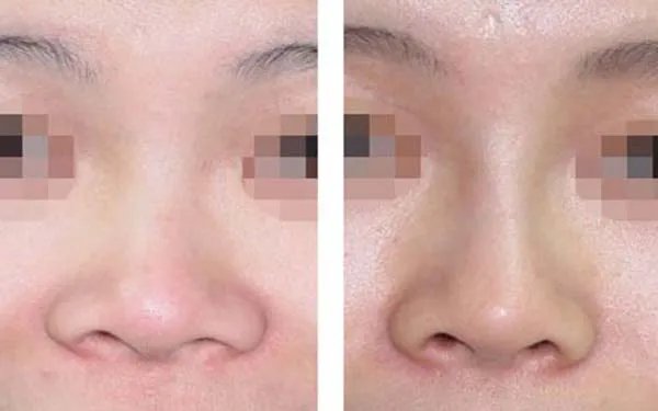 纹眉的价格
