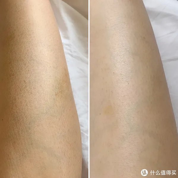 皮肤长期拔干,可能是自来水出了问题——A.O.史密斯美容软水机