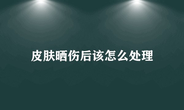 皮肤晒伤后该怎么处理