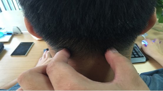 风池穴是什么