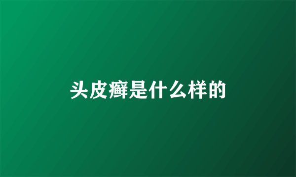 头皮癣是什么样的