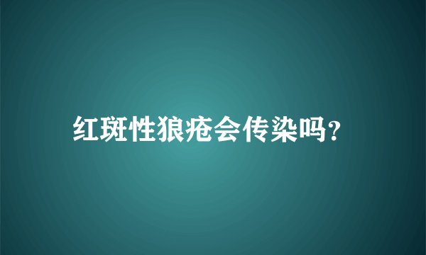 红斑性狼疮会传染吗？