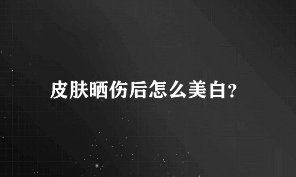 皮肤晒伤后怎么美白？