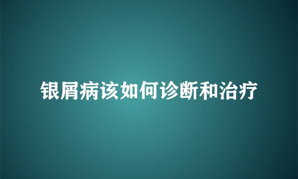 银屑病该如何诊断和治疗