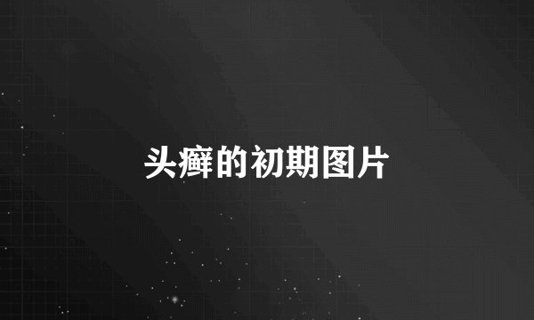 头癣的初期图片