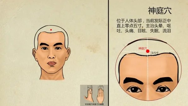 神庭穴