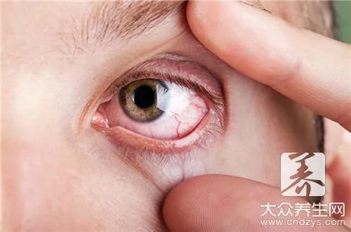  眼角膜在哪个位置图片