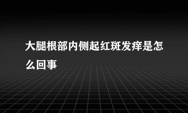 大腿根部内侧起红斑发痒是怎么回事
