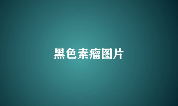 黑色素瘤图片