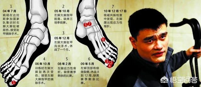 朱婷的手腕为什么会受伤?会像姚明、刘翔一样可惜了运动生涯吗?