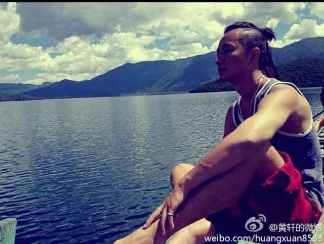 大家对男明星整容有什么看法?