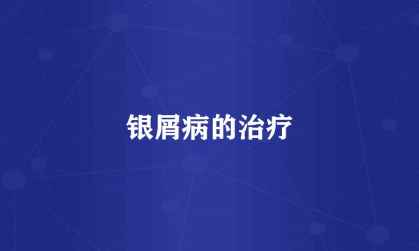 银屑病的治疗