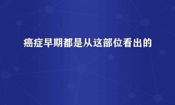 癌症早期都是从这部位看出的