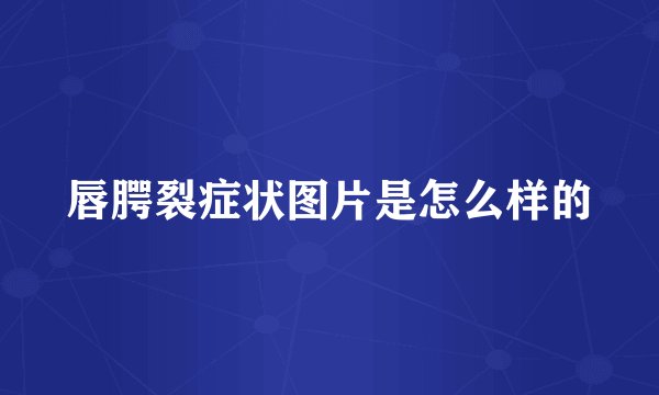 唇腭裂症状图片是怎么样的