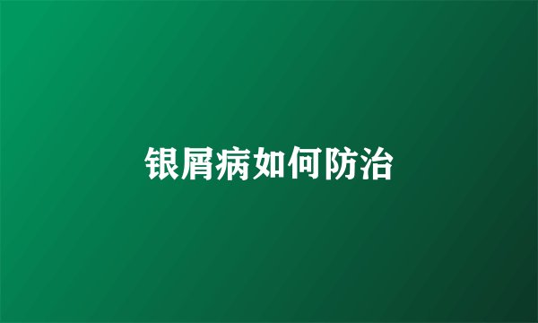 银屑病如何防治