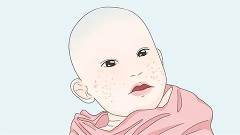 小儿如何提高免疫力