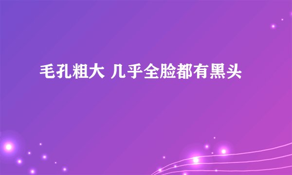 毛孔粗大 几乎全脸都有黑头