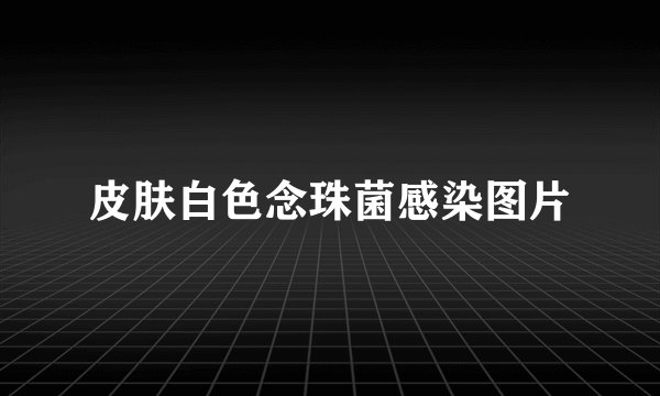 皮肤白色念珠菌感染图片
