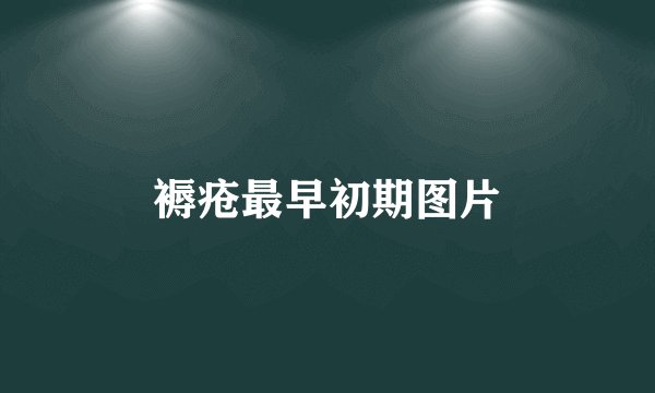 褥疮最早初期图片