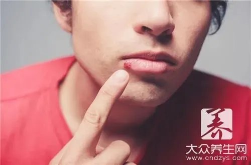 嘴角溃疡怎样好的最快?