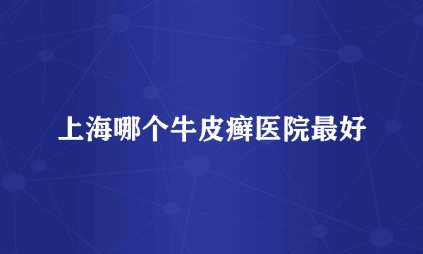 上海哪个牛皮癣医院最好