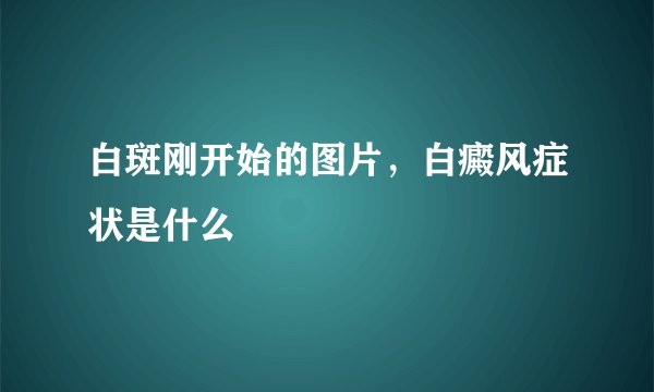 白斑刚开始的图片，白癜风症状是什么