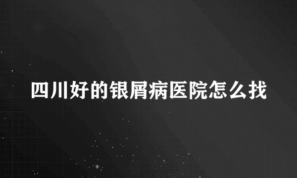 四川好的银屑病医院怎么找