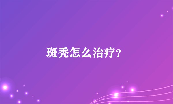 斑秃怎么治疗？