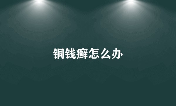 铜钱癣怎么办