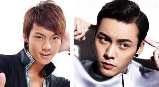 大家对男明星整容有什么看法?