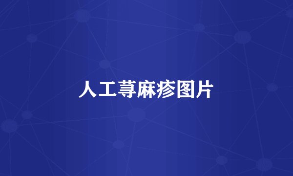 人工荨麻疹图片
