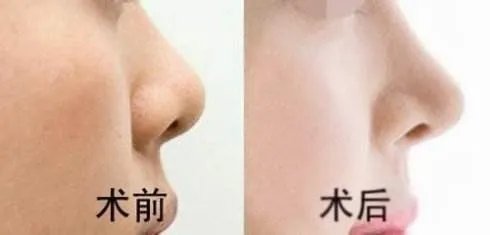 2021常州美贝尔医疗美容医院隆鼻价格表(价目表)怎么样?