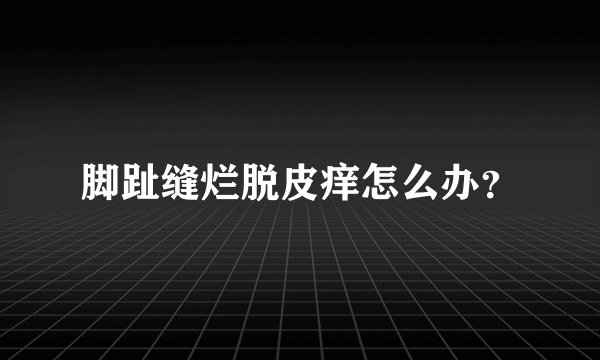 脚趾缝烂脱皮痒怎么办？