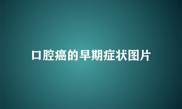 口腔癌的早期症状图片